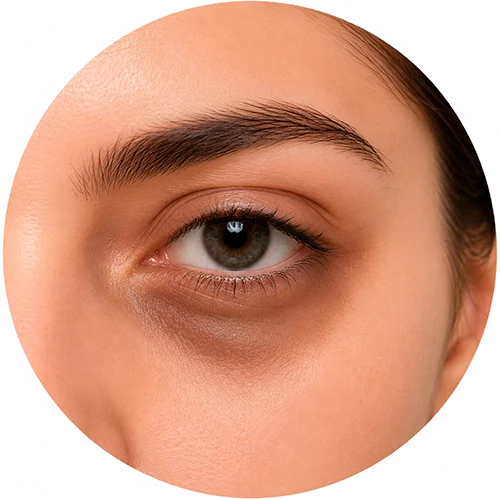 EMS_eye_massager_helping_reduce_dark_circles_and_brighten_under_eye_skin